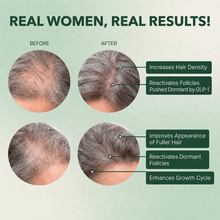 Vital Hair Complex