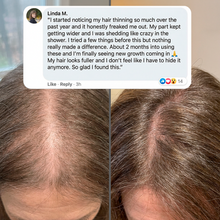 Vital Hair Complex
