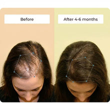 Vital Hair Complex
